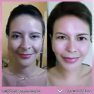 Read more about the article ⁗ Illuderma Review ⁗ Sep . Updates Illuderma Serum Drops Real Customer Reviews 2024