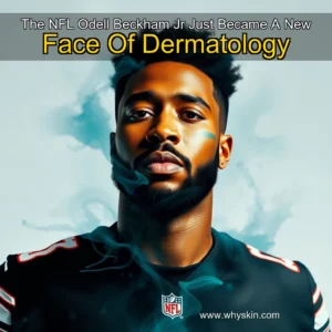 Read more about the article The NFL Odell Beckham Jr  Just Became A New Face Of Dermatology