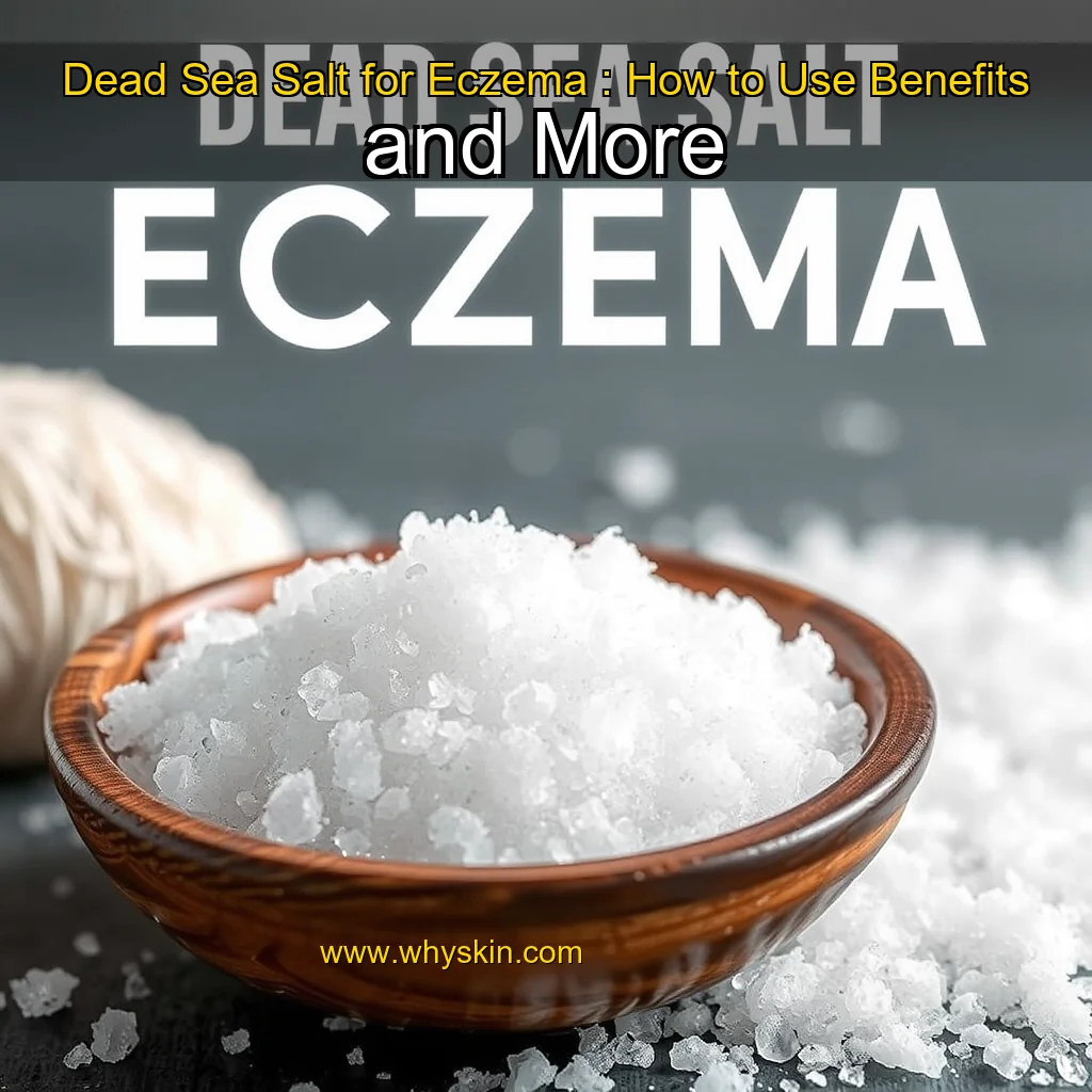 You are currently viewing Dead Sea Salt for Eczema : How to Use  Benefits  and More
