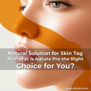 Read more about the article Natural Solution for Skin Tag Removal: Is Natura Pro the Right Choice for You?