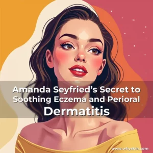 Read more about the article Amanda Seyfried’s Secret to Soothing Eczema and Perioral Dermatitis